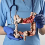 Gastroenterology min