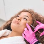 Profhilo Treatments in London: The Ultimate Guide to Radiant, Youthful Skin