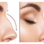 Rhinoplasty Surgeon in Lahore