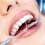 Dental Implants vs Bridges