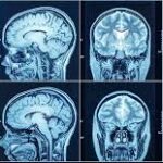 CT Scan Centre Near Me