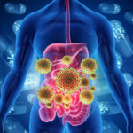 Digestive Remedies