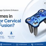 How Cervical Cage Systems Enhance Outcomes in Anterior Cervical Spine Fusion