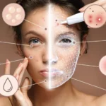 Skin Analysis 1024x576 1