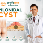 Pilonidal Sinus Doctor in Ghaziabad