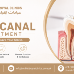 Root Canal Treatment in islamabad