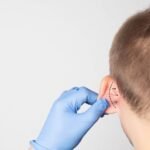 A plastic surgeon doctor examines a male patient s ear for an otoplasty operation. The concept of removing deafness, copy space